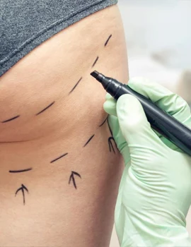 Chirurgie des fesses